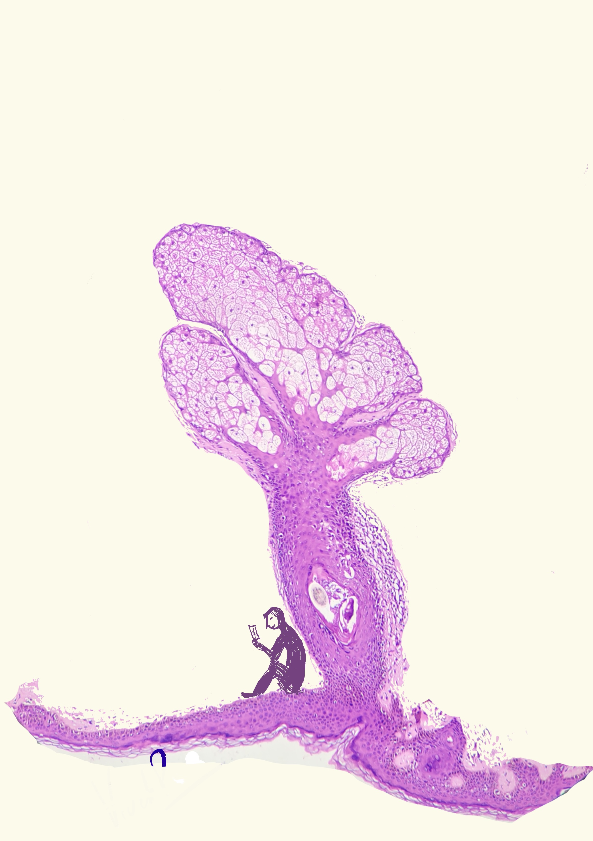 <b>Second Prize</b>